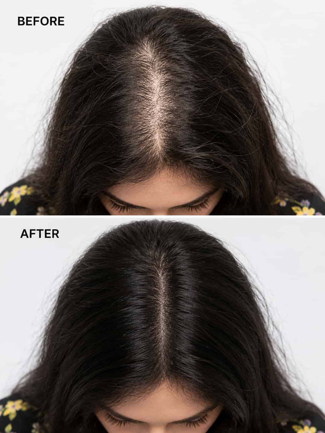 VEVANA Complete Hair Combo