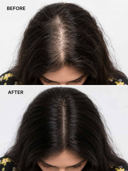 VEVANA Complete Hair Combo