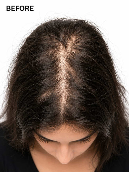 VEVANA Organic Hair Oil